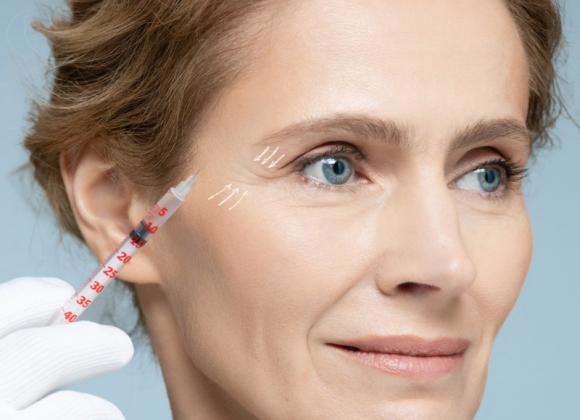 Séance de mésothérapie